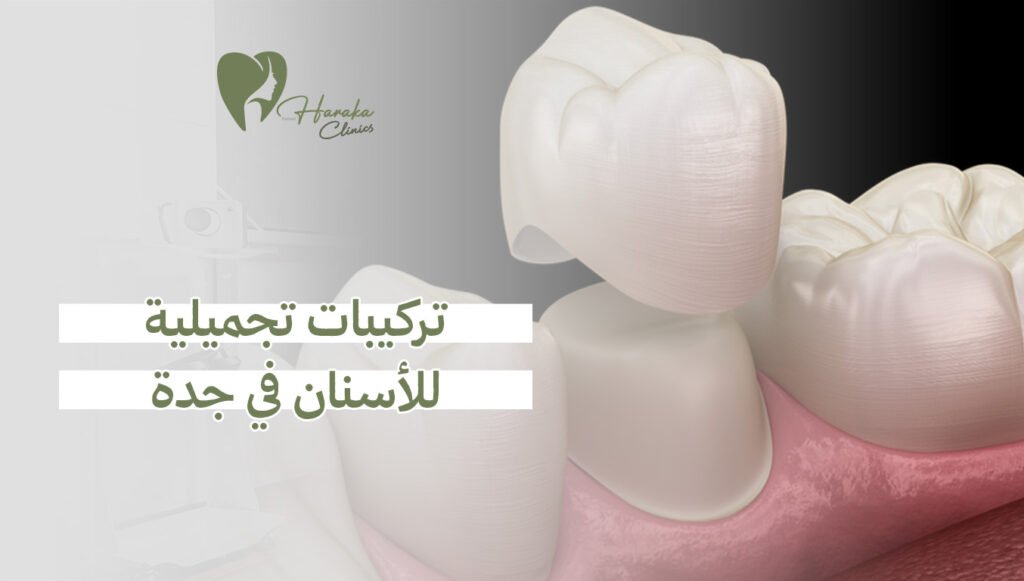 تركيبات تجميلية للأسنان في جدة