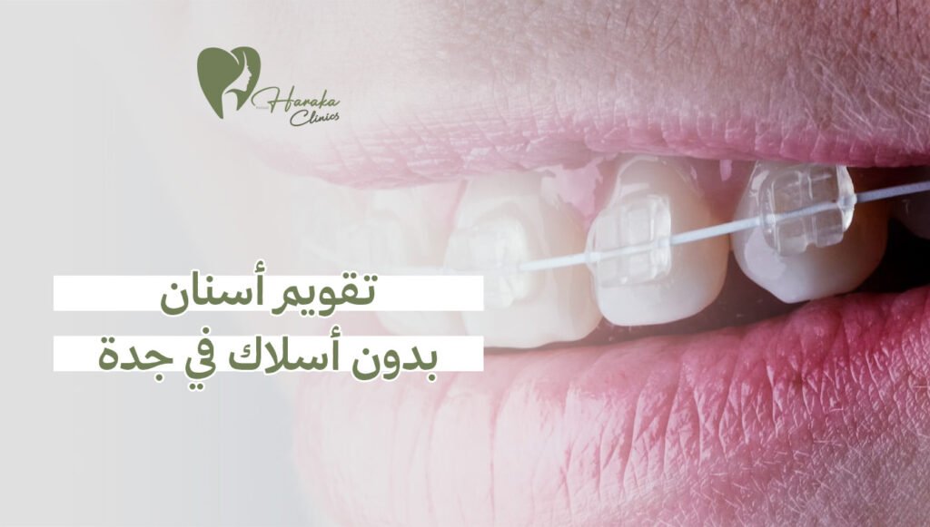 تقويم أسنان بدون أسلاك في جدة | احجز الآن لابتسامة مثالية بسهولة