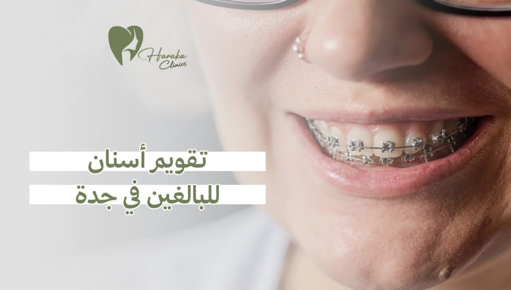 تقويم أسنان للبالغين في جدة