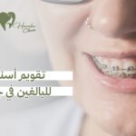 تقويم أسنان للبالغين في جدة