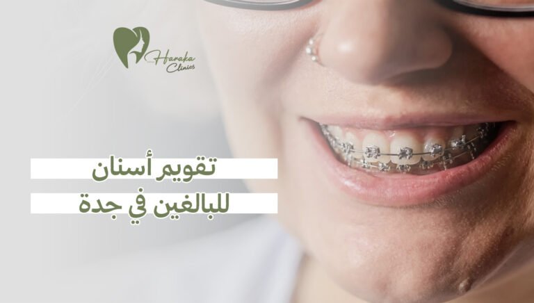 تقويم أسنان للبالغين في جدة