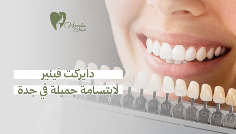 دايركت فينير لابتسامة جميلة في جدة