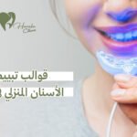 قوالب تبييض الأسنان المنزلي في جدة